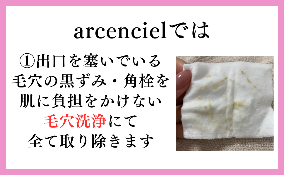 arcencielでは
①出口を塞いでいる毛穴の黒ずみ・角栓を肌に負担をかけない毛穴洗浄にて全て取り除きます