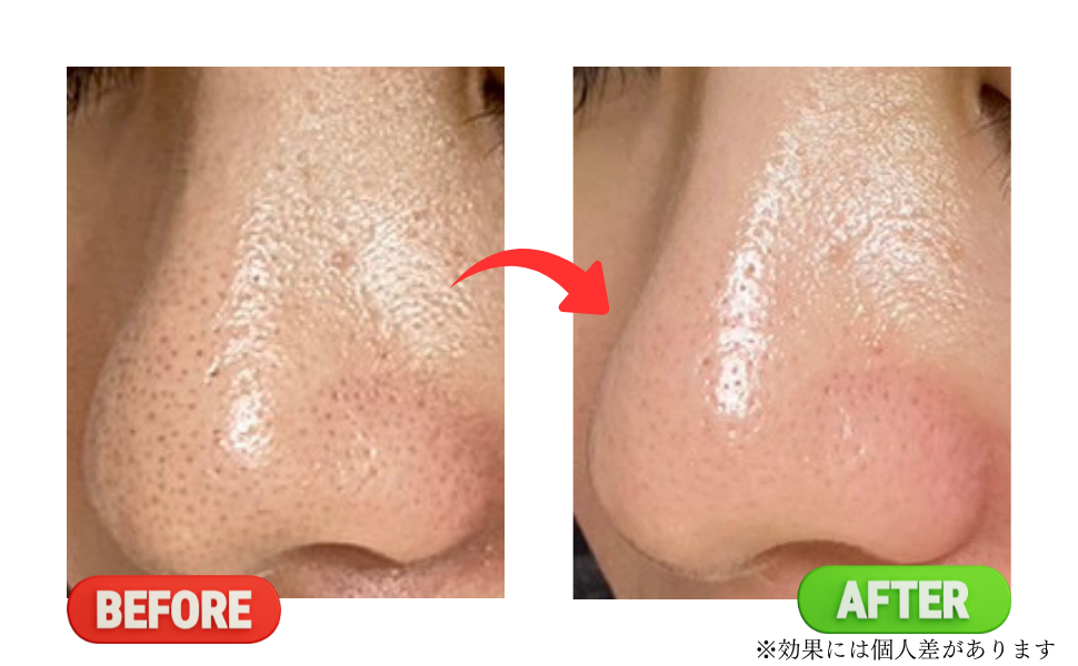 Before
after