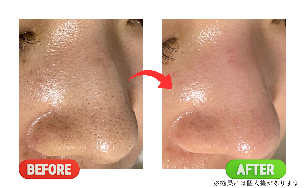 Before
after