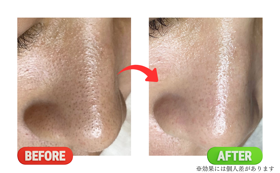 Before
after
