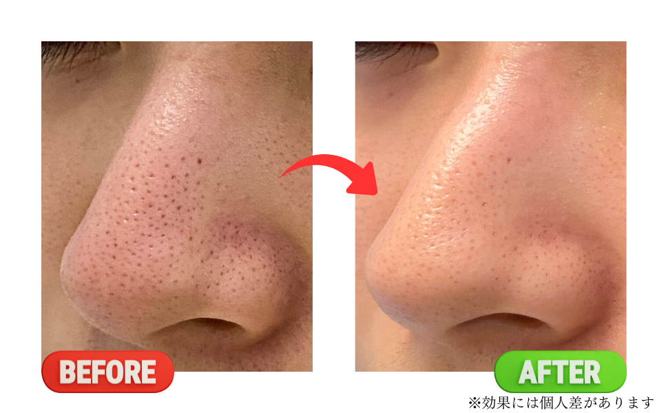 Before
after