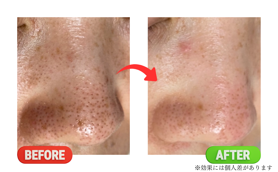Before
after