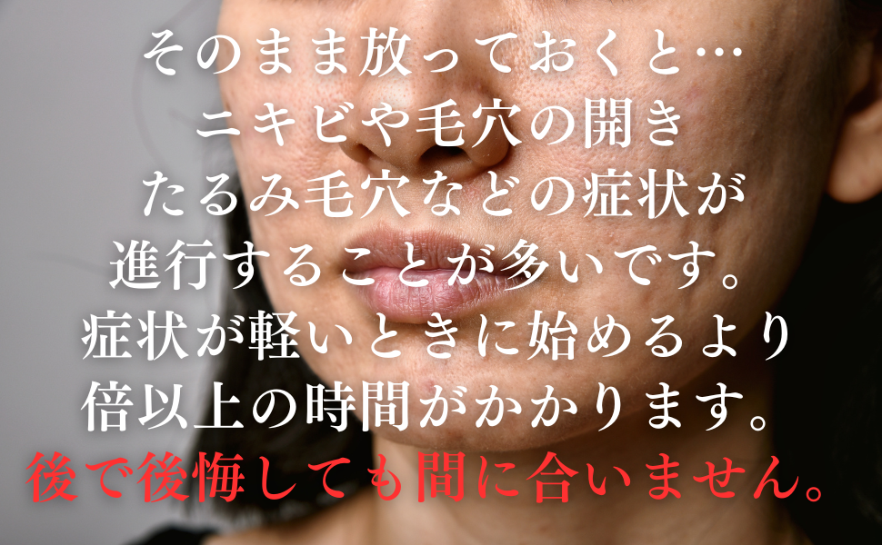 そのまま放っておくと…
ニキビや毛穴の開き
たるみ毛穴などの症状が
進行することが多いです。
症状が軽いときに始めるより
倍以上の時間がかかります。
後で後悔しても間に合いません。