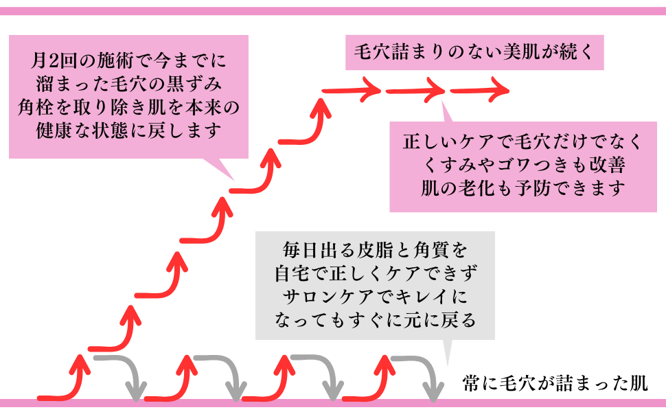 月2回の施術で今までに溜まった毛穴の黒ずみ角栓を取り除き肌を本来の健康な状態に戻します
毛穴詰まりのない美肌が続く
正しいケアで毛穴だけでなくくすみやゴワつきも改善
肌の老化も予防できます
毎日出る皮脂と角質を自宅で正しくケアできずサロンケアでキレイになってもすぐに元に戻る
常に毛穴が詰まった肌